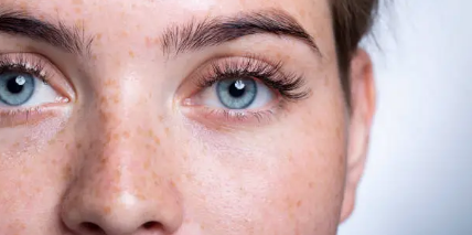 LASIK eye surgery